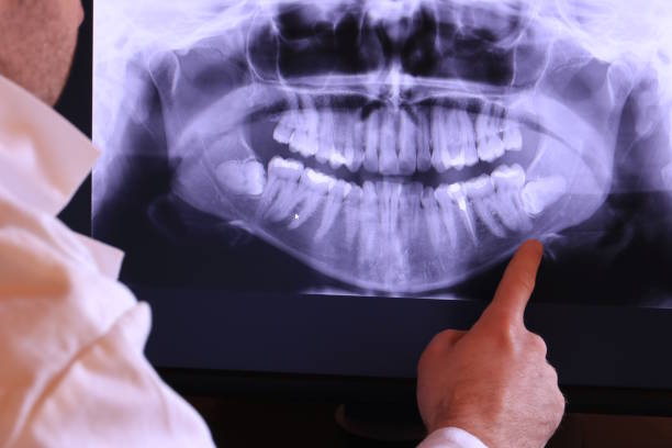 Best Mobile Emergency Dentist in Nazareth, PA