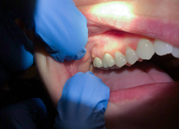Best Urgent Dental Care for Toothache in Nazareth, PA